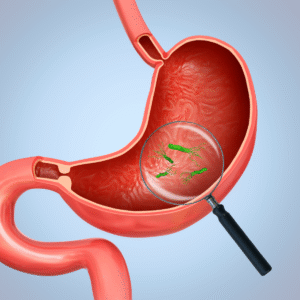 Image of H. Pylori in stomach.